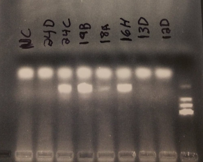 PCR